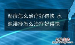 湿疹怎么治疗好得快 水泡湿疹怎么治疗好得快