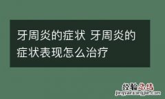 牙周炎的症状 牙周炎的症状表现怎么治疗